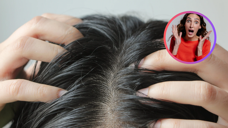 10 rimedi per capelli grassi