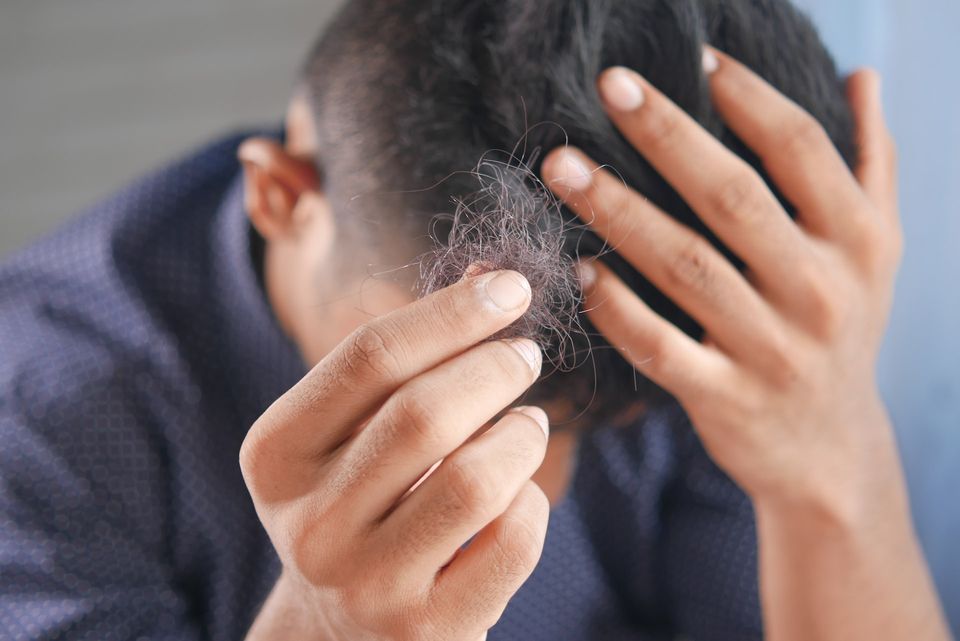 Caduta dei capelli dovuta allo stress: ecco 4 soluzioni da adottare